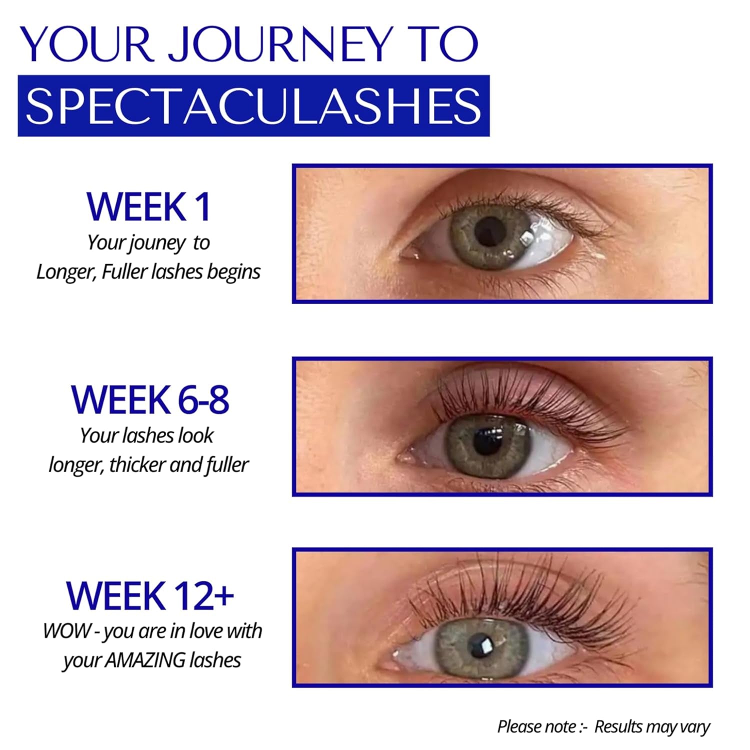 Lash Serum for Eyelash Growth - Eyelash Serum Growth - Eyelash Growth Serum - Eye Lash Serum Growth - Lash Growth Serum - Eyelash Enhancing Serum - Suero Para Pestañas Crecimiento (XL)